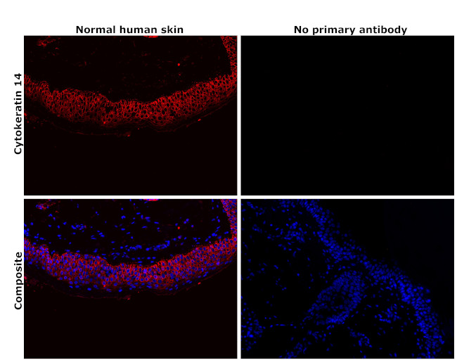 Cytokeratin 14 Antibody in Immunohistochemistry (Paraffin) (IHC (P))