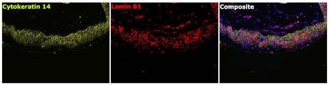 Cytokeratin 14 Antibody in Immunohistochemistry (Paraffin) (IHC (P))