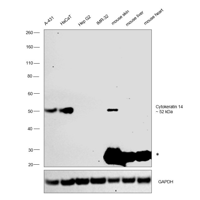 Cytokeratin 14 Antibody in Western Blot (WB)