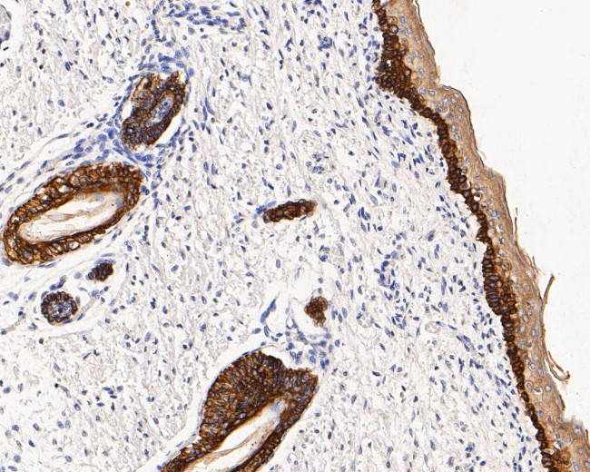 Cytokeratin 14 Antibody in Immunohistochemistry (Paraffin) (IHC (P))