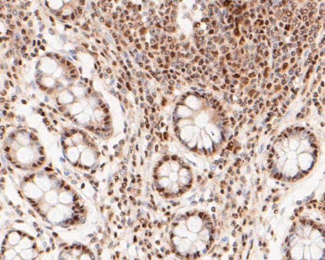 MTA2 Antibody in Immunohistochemistry (Paraffin) (IHC (P))