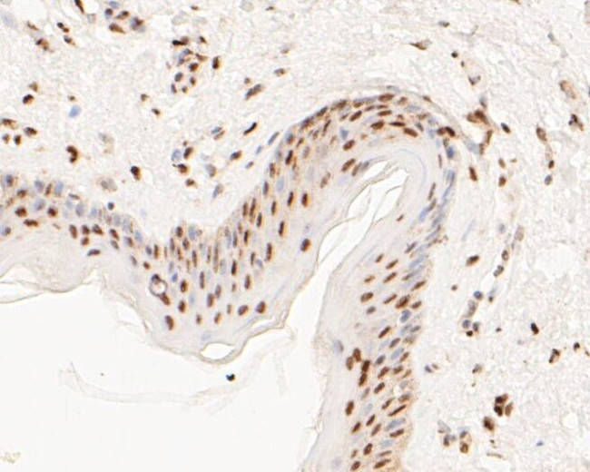 MTA2 Antibody in Immunohistochemistry (Paraffin) (IHC (P))