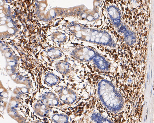 USP21 Antibody in Immunohistochemistry (Paraffin) (IHC (P))