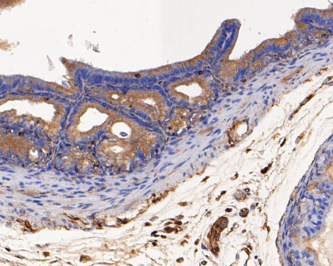 USP21 Antibody in Immunohistochemistry (Paraffin) (IHC (P))