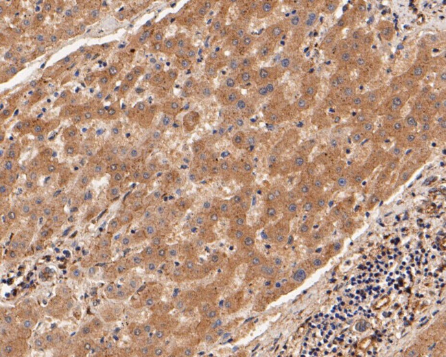 USP21 Antibody in Immunohistochemistry (Paraffin) (IHC (P))