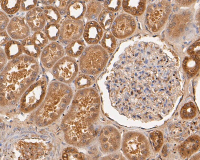 USP21 Antibody in Immunohistochemistry (Paraffin) (IHC (P))