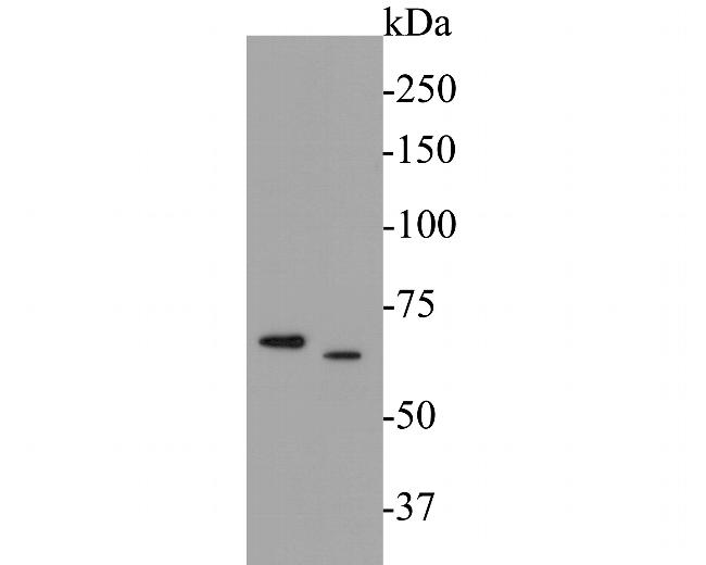 USP21 Antibody in Western Blot (WB)