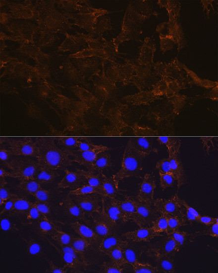 beta Catenin Antibody in Immunocytochemistry (ICC/IF)