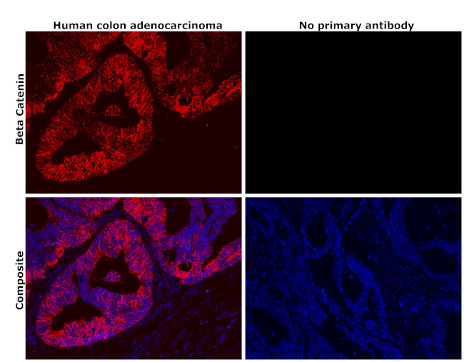 beta Catenin Antibody in Immunohistochemistry (Paraffin) (IHC (P))