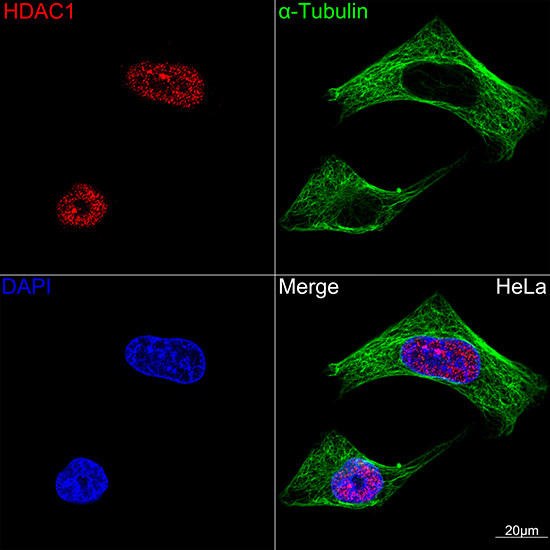 HDAC1 Antibody in Immunocytochemistry (ICC/IF)