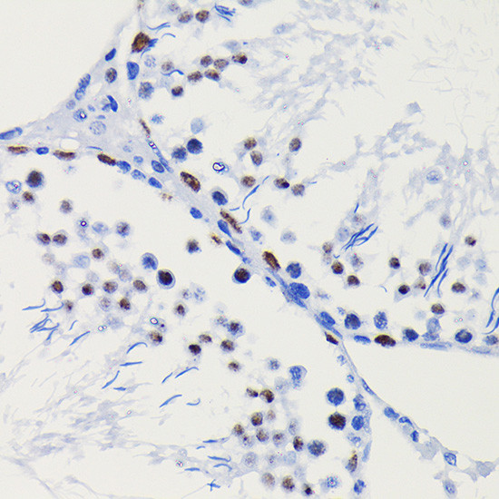 HDAC1 Antibody in Immunohistochemistry (Paraffin) (IHC (P))