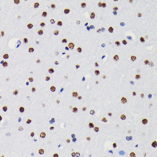 HDAC1 Antibody in Immunohistochemistry (Paraffin) (IHC (P))