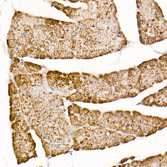 TOM20 Antibody in Immunohistochemistry (Paraffin) (IHC (P))