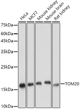 TOM20 Antibody in Western Blot (WB)