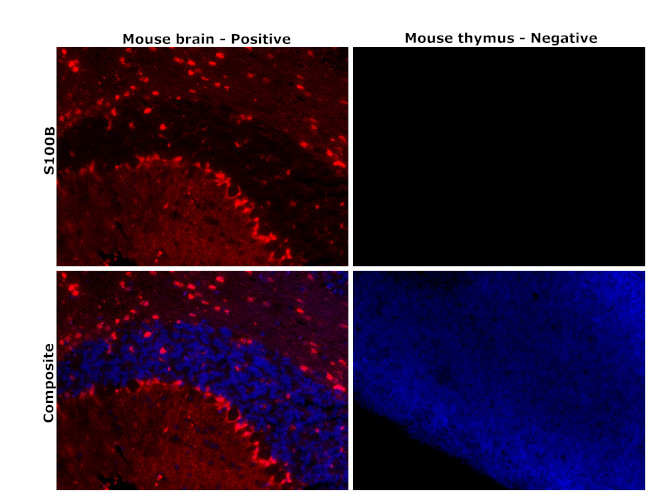 S100B Antibody in Immunohistochemistry (Paraffin) (IHC (P))