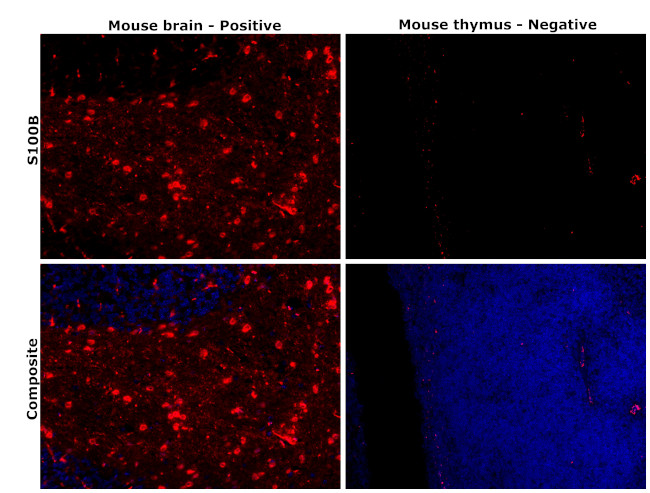 S100B Antibody in Immunohistochemistry (Paraffin) (IHC (P))