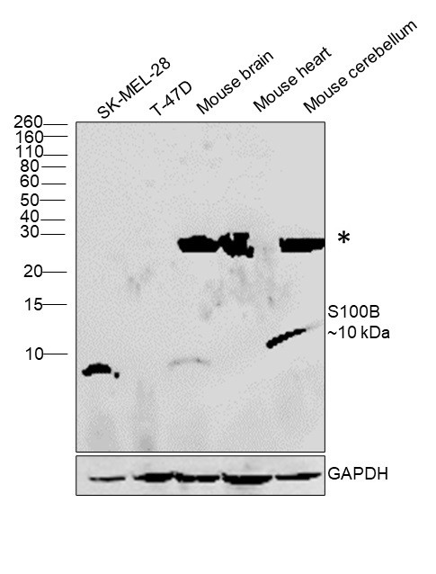 S100B Antibody in Western Blot (WB)