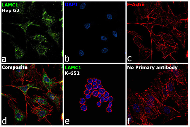 Laminin gamma-1 Antibody in Immunocytochemistry (ICC/IF)