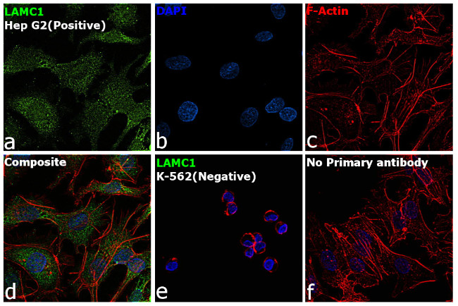 Laminin gamma-1 Antibody in Immunocytochemistry (ICC/IF)