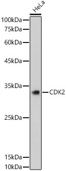 CDK2 Antibody in Western Blot (WB)