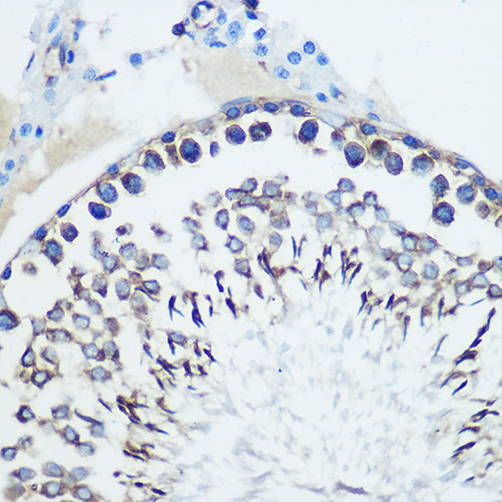 CCR7 Antibody in Immunohistochemistry (Paraffin) (IHC (P))