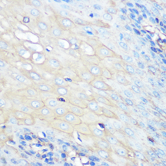 CCR7 Antibody in Immunohistochemistry (Paraffin) (IHC (P))