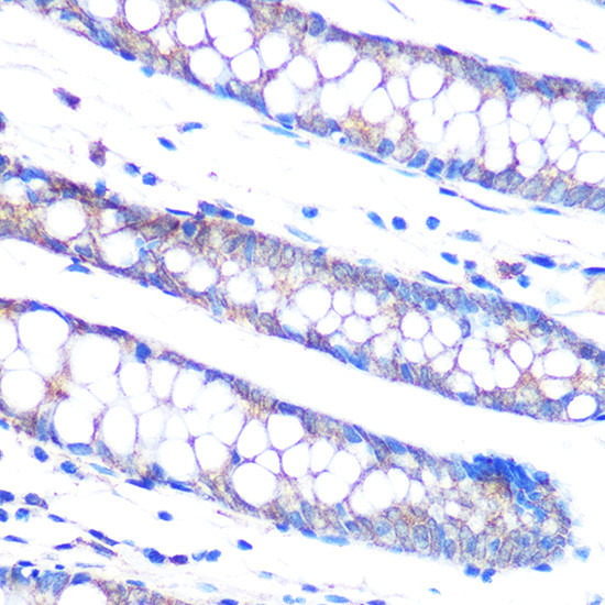 MKP3 Antibody in Immunohistochemistry (Paraffin) (IHC (P))