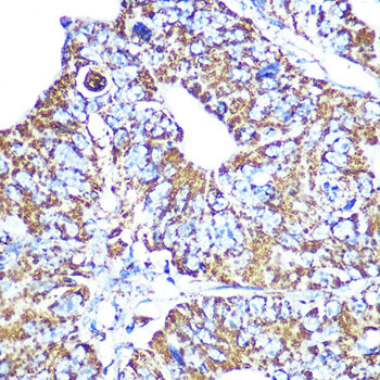 HSP60 Antibody in Immunohistochemistry (Paraffin) (IHC (P))