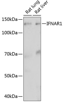 IFNAR1 Antibody in Western Blot (WB)