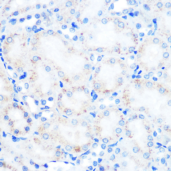 LAMP2 Antibody in Immunohistochemistry (Paraffin) (IHC (P))