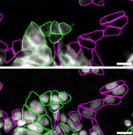 LRP1 Antibody in Immunocytochemistry (ICC/IF)