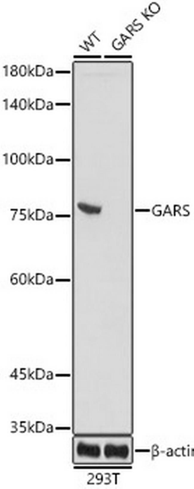 GARS Antibody