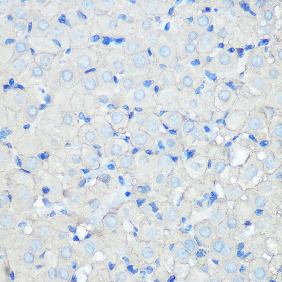 SR-BI Antibody in Immunohistochemistry (Paraffin) (IHC (P))