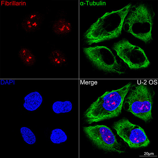 Fibrillarin Antibody in Immunocytochemistry (ICC/IF)