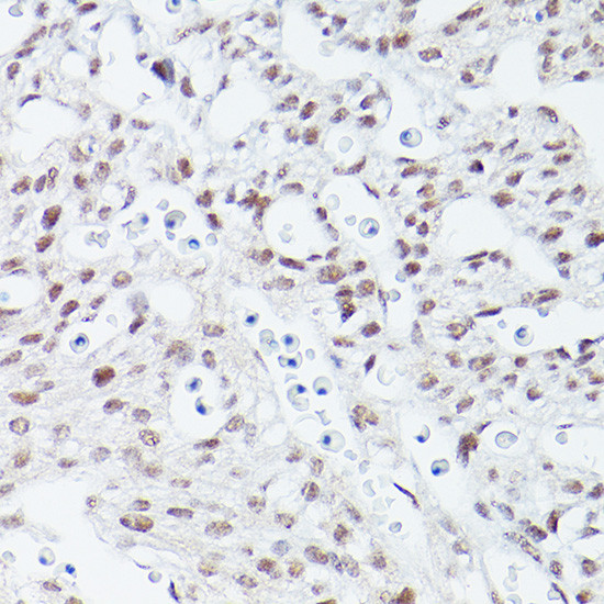 ISL1 Antibody in Immunohistochemistry (Paraffin) (IHC (P))