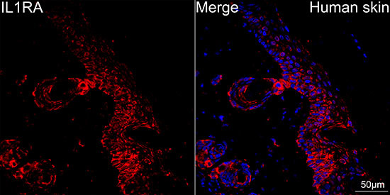 IL1RA Antibody in Immunohistochemistry (Paraffin) (IHC (P))