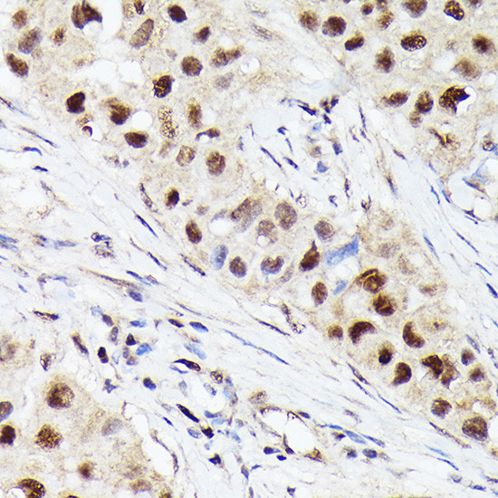 CDK4 Antibody in Immunohistochemistry (Paraffin) (IHC (P))