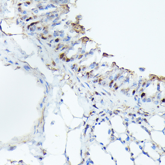 CDK4 Antibody in Immunohistochemistry (Paraffin) (IHC (P))