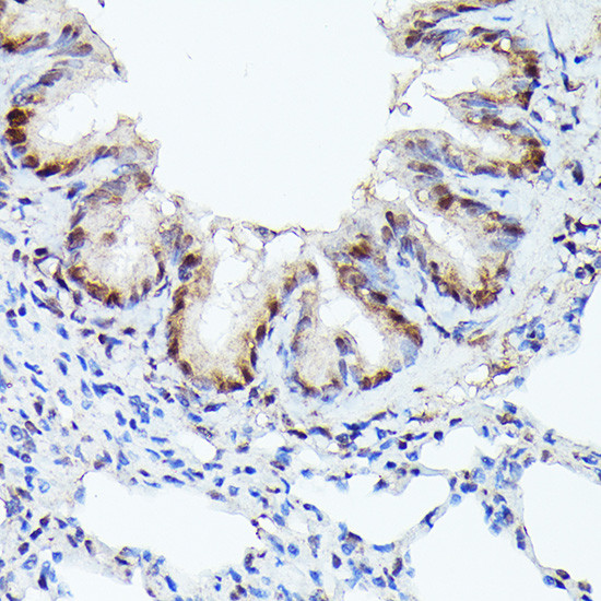 CDK4 Antibody in Immunohistochemistry (Paraffin) (IHC (P))