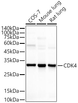 CDK4 Antibody in Western Blot (WB)