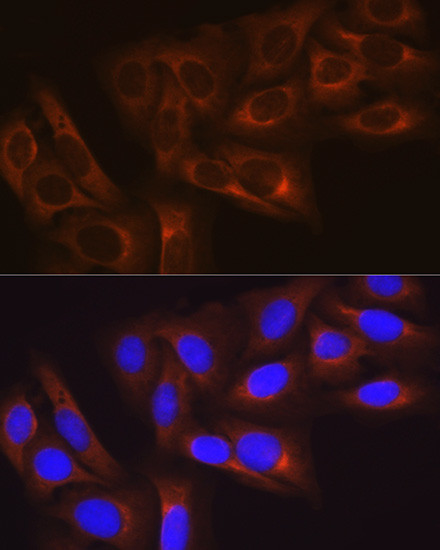 HSP27 Antibody in Immunocytochemistry (ICC/IF)