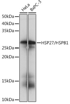 HSP27 Antibody in Western Blot (WB)