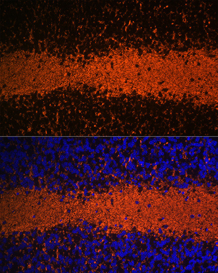 MBP Antibody in Immunohistochemistry (Paraffin) (IHC (P))