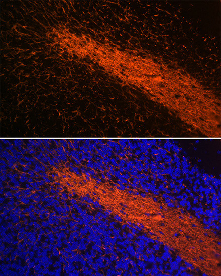 MBP Antibody in Immunohistochemistry (Paraffin) (IHC (P))