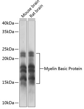 MBP Antibody in Western Blot (WB)