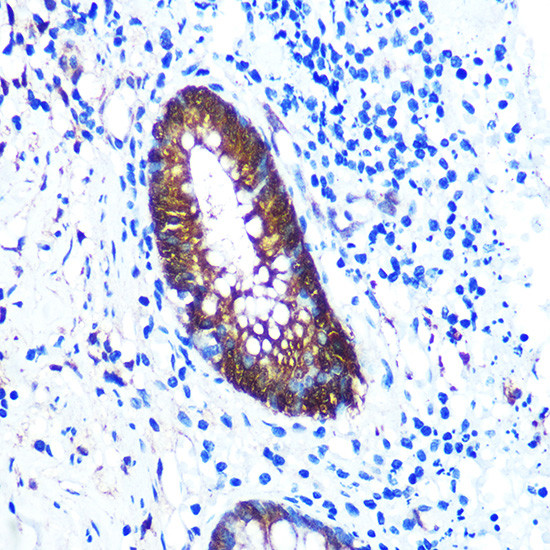 Galectin 3 Antibody in Immunohistochemistry (Paraffin) (IHC (P))