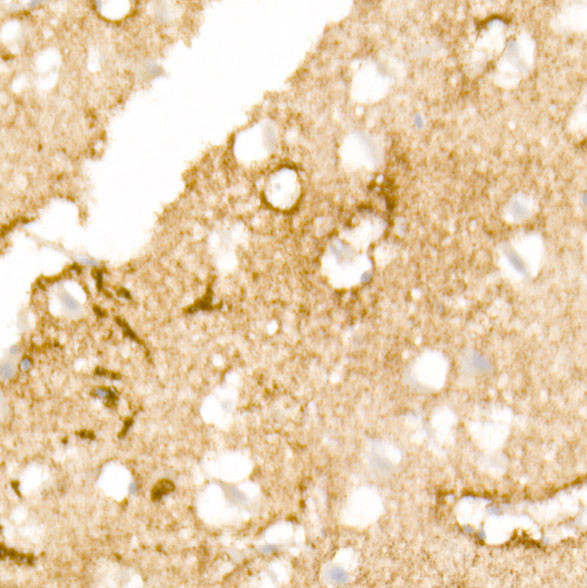 Aquaporin 4 Antibody in Immunohistochemistry (Paraffin) (IHC (P))