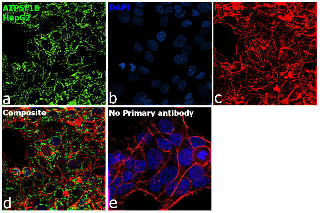 ATP Synthase beta Antibody in Immunocytochemistry (ICC/IF)