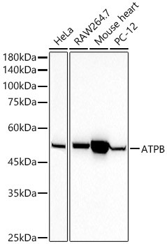 ATP Synthase beta Antibody in Western Blot (WB)