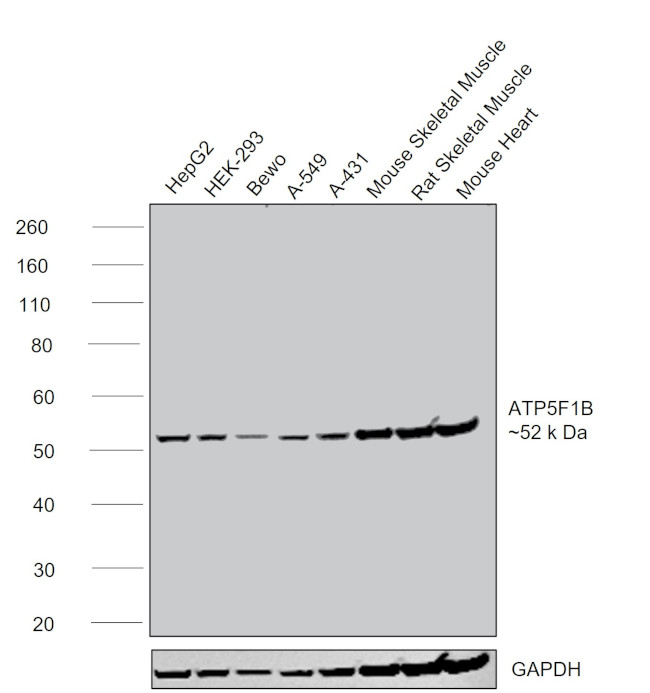 ATP Synthase beta Antibody in Western Blot (WB)